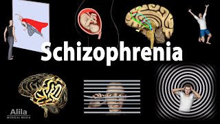 Schizophrenia: Symptoms, Cause, Pathophysiology, Diagnosis and Treatments, Animation.