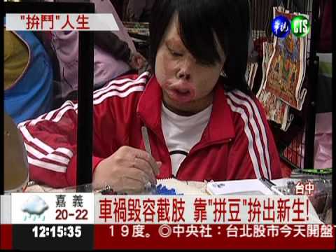 車禍毀容截肢 靠"拼豆"拚出新生!