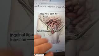 Download lagu Testicular pain after hernia repair #malepelvicfloor mp3