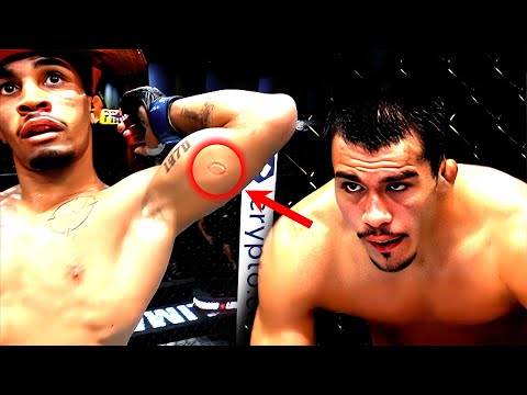 UFC Fighter Who Got Bit Last Night Already Got The Bite Mark Tattooed