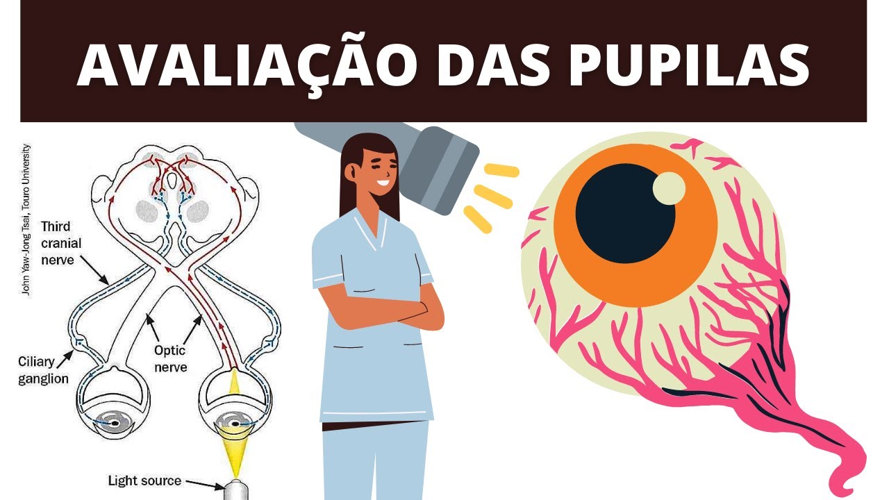 O QUE VOCÊ PRECISA SABER SOBRE AVALIAÇÃO DAS PUPILAS