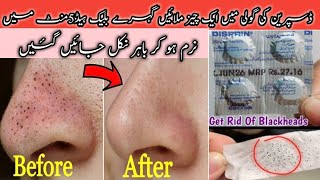 How To Remove Blackheads Permanently From Nose & Face Instantly | Naturally At Home | No Whiteheads