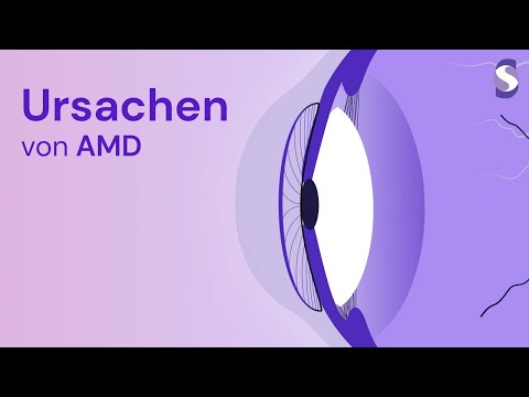 An AMD erkrankt: die häufigsten Ursachen