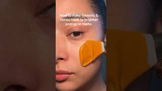 This turmeric &amp; honey mask will help tackle post acne marks and reduce uneven skin-tone🍯