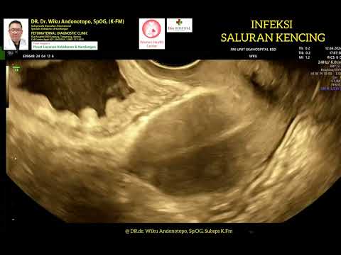 Infeksi Saluran Kemih - Nyeri perut bawah