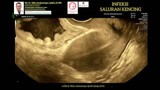 Download lagu Infeksi Saluran Kemih - Nyeri perut bawah mp3