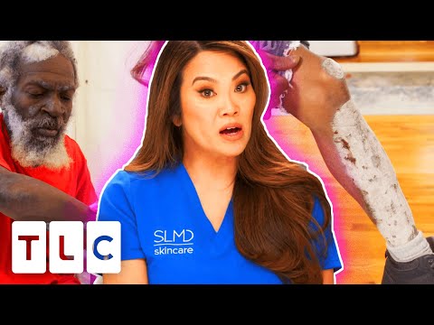 “This Is One Of The Worst Cases Of Psoriasis That I’ve Ever Seen!” | Dr Pimple Popper