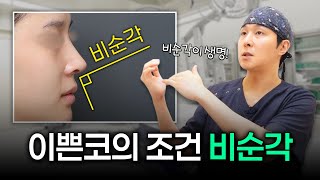 비순각 교정 수술 코끝·입술 각도, 이렇게 바꿔야 예뻐집니다