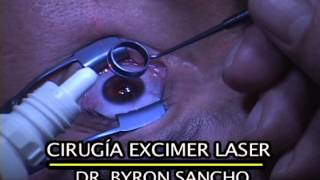 Excimer Laser Testimonio cirugía para corrección de miopía y astigmatismo - Clínica Sancho