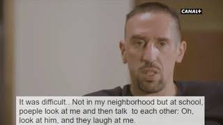 Franck Ribéry talks about his scar and how he was mocked at school..