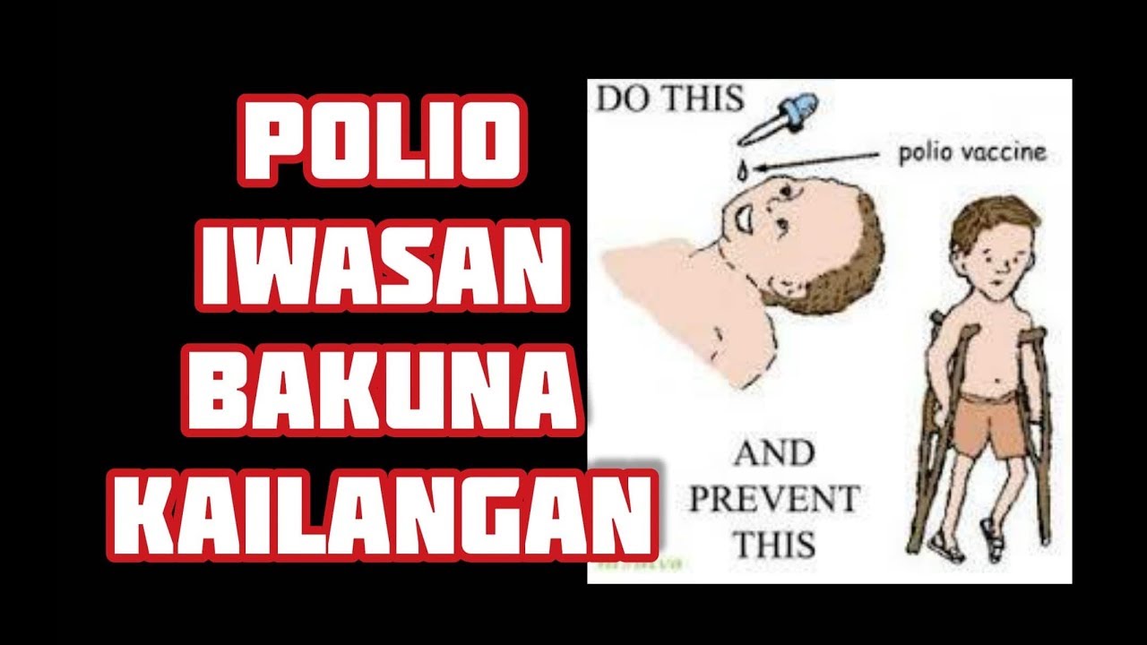 Polio Epidemic: Apektado ka ba at si Baby - Payo ni Doc Willie Ong #784