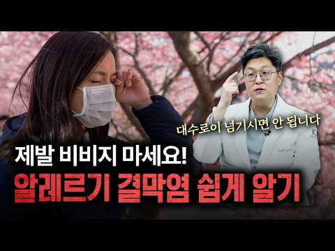 봄철 불청객 '알레르기성 결막염', 눈 비비지 말고 이렇게 대처하세요! | 건양대병원 김국영 교수