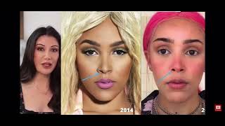 Lorry Hill - Doja Cat Plastic Surgery Analysis (REUPLOADED)