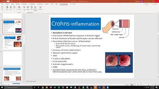 GI Part 3 (Crohns & Ulcerative Colitis)