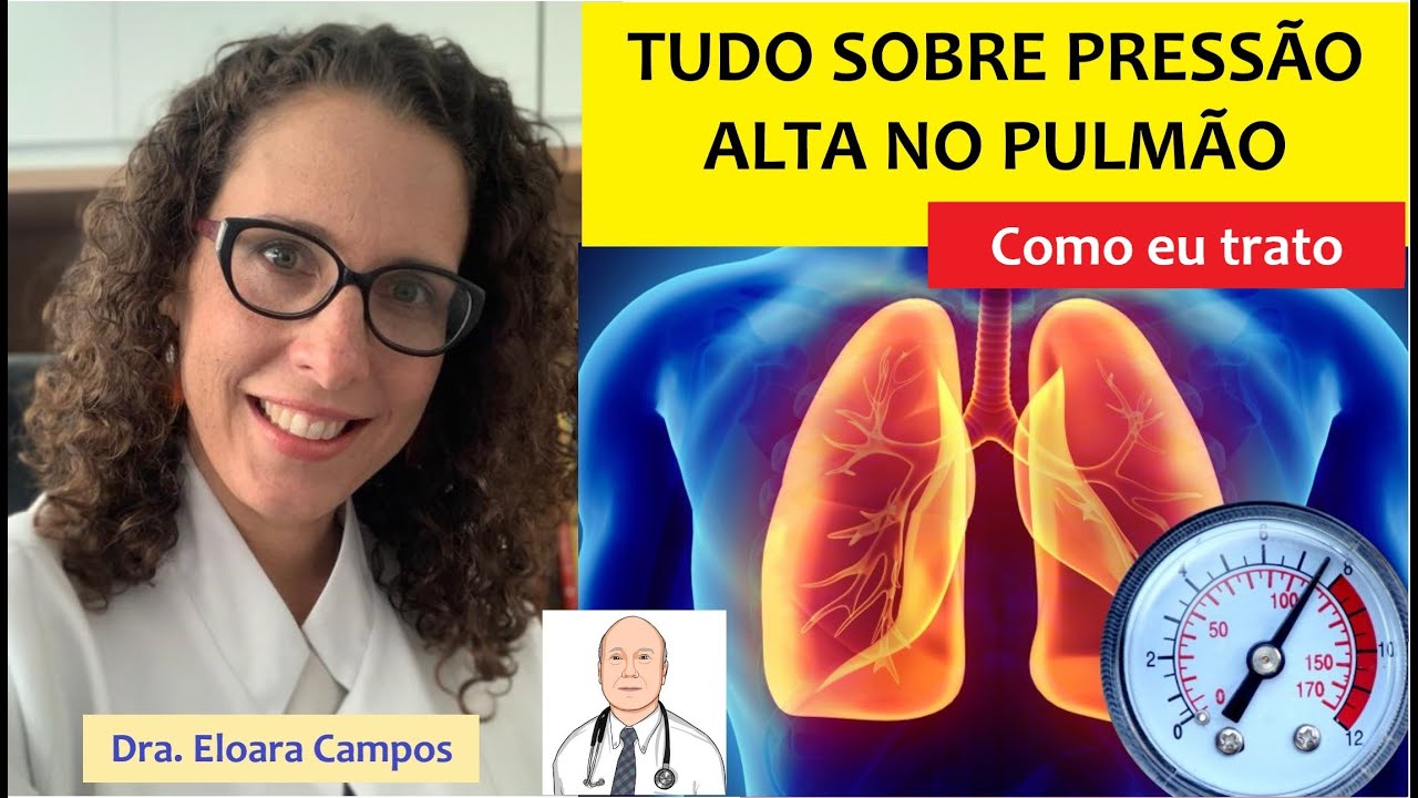 Hipertensão arterial pulmonar na visão do pneumologista