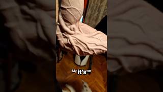 The CRAZIEST Veins 🤯 #shorts