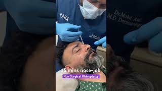 Non surgical rhinoplasty | Instant nose job results in just 15 mins