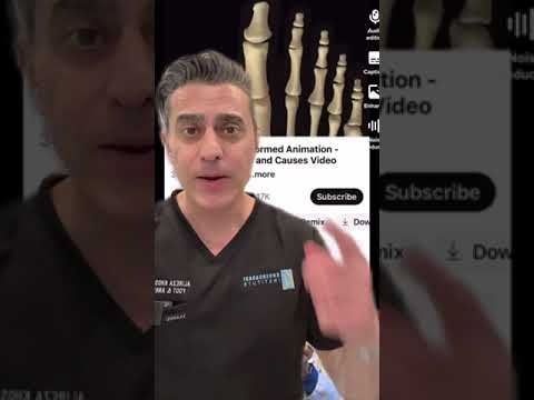 Foot Doctor tells Foot why it has a Bunion