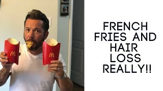 Hair Replacement Men's Hair System Review French Fries and Hair Regrowth, Really!!