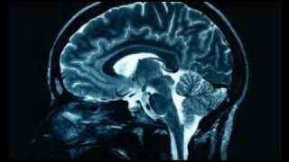 Why Religion causes brain damage