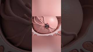 Breast Cancer: How Tumors Begin to Grow