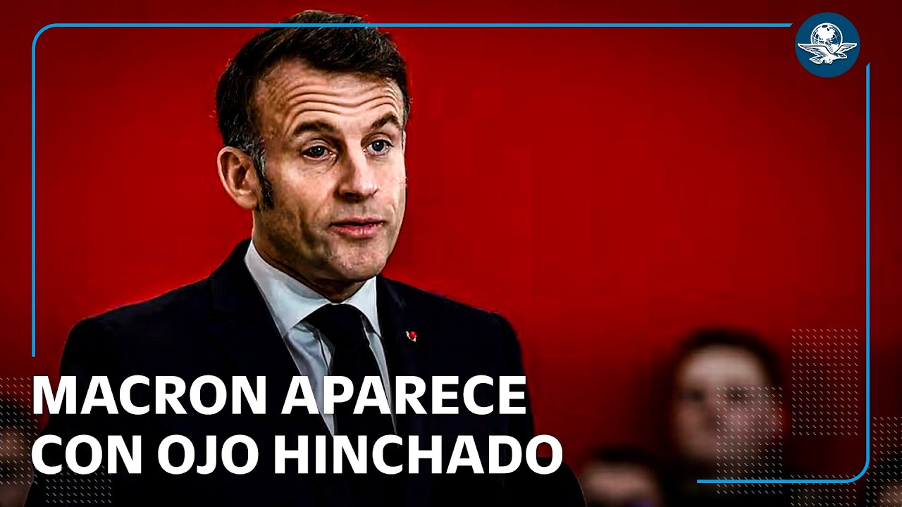¿Qué le pasó a Macron? Presidente de Francia aparece con ojo enrojecido
