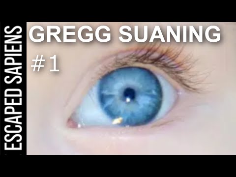 Curing Blindness With Bionic Eyes | Gregg Suaning | Escaped Sapiens Podcast #1