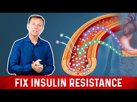 7 Things That Boost Insulin Sensitivity or Reverse Insulin Resistance - Dr. Berg