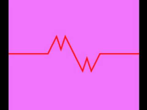 LIFE (Gizgier rmx) - Overthrill ft. Miss Wonder