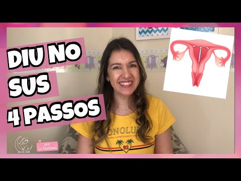 Vídeo: DIU pelo SUS: perguntas e respostas