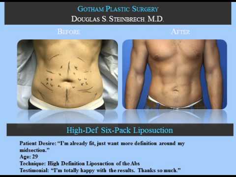 free gotham plastic surgery