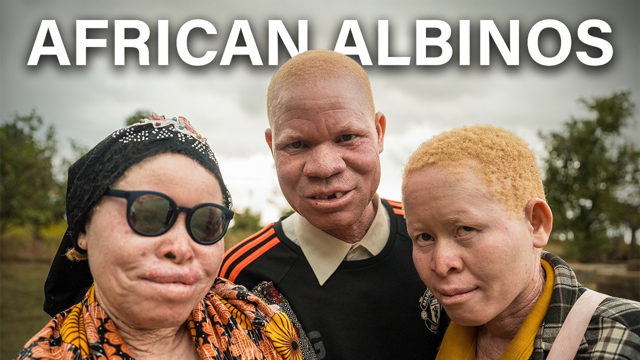 THE SECRET ISLAND OF AFRICAN ALBINOS 🇹🇿