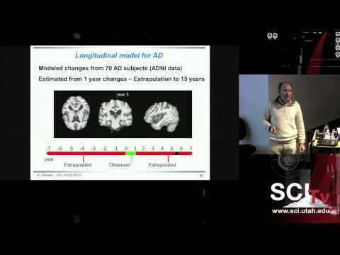 The stationary velocity field framework for modeling the progression of Alzheimer's disease