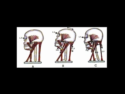 Farmaci di mal di schiena e al collo Spine sulle vertebre della colonna vertebrale cervicale