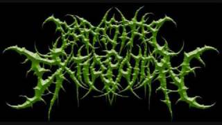 Parasitic Extirpation - Stabwound Symmetry