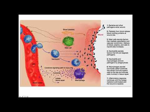 image-How are wounds classified according to severity?