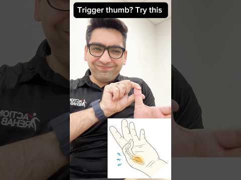 Trigger Thumb relief in seconds! #trigger #thumbpain #thumb #painrelief #foryou #finger #fingerjoint