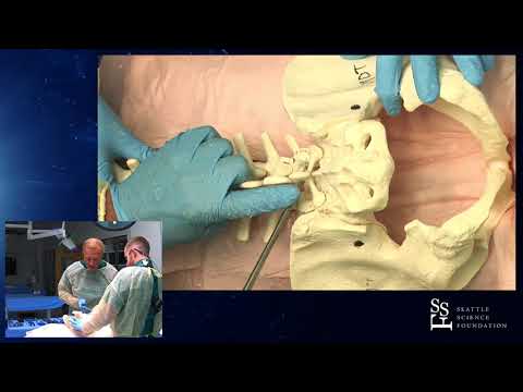 Efficient Posterior Lumbar Decompression Surgery - Jens R. Chapman, M.D., Brooks Osburn, M.D.