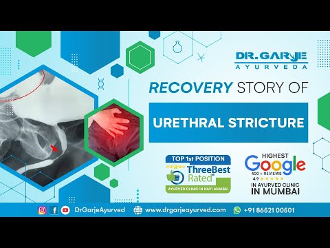  Panchakarma Patient Testimonial - Review 14