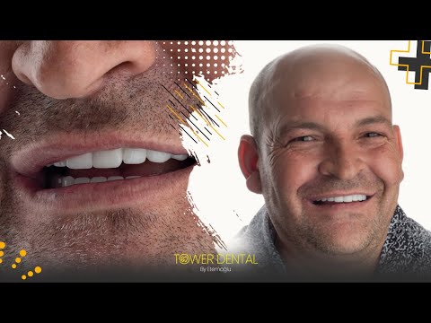 Logo of Painless Dental Implants and Restorative Dentistry in Istanbul, Turkey – Modern Techniques