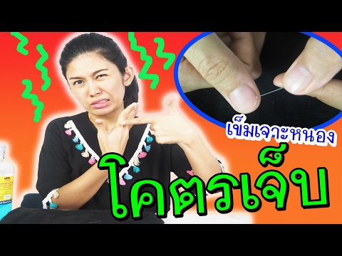 Negarmonalnye โรคสะเก็ดเงินครีม โรคสะเก็ดเงินครีมสมุนไพร