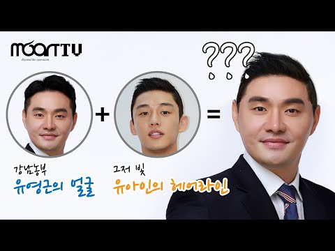 남자 헤어라인 수술 | 유아인 머리처럼 저도 할 수 있나요 농부님?! 남성 헤어라인의 디테일