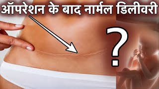 ऑपरेशन के बाद नार्मल डिलीवरी किन महिलाओं की हो पाती है video