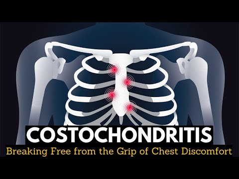 Costochondritis: Breaking Free from the Grip of Chest Discomfort