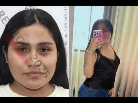 Mujer se hace ecografía y muere: Esposo denuncia supuesta negligencia