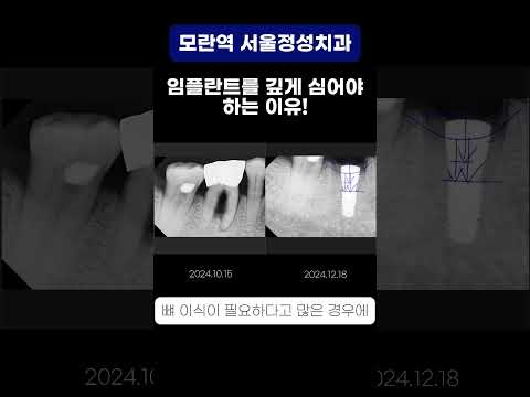 땡큐성형외과 Clips