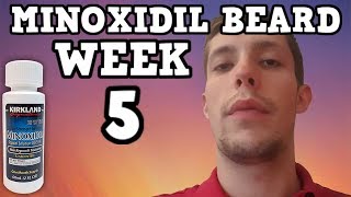 Minoxidil Beard | Week 5 | The Experiment |  #Facialfuzzfridays