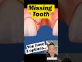 3 Options for Replacing a Missing Tooth (Dentist Explains) #dentallan #dentist #shorts