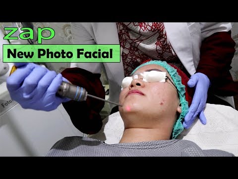 download lagu mp3 mp4 Cara Perawatan Wajah Bekas Jerawat, download lagu Cara Perawatan Wajah Bekas Jerawat gratis, unduh video klip Cara Perawatan Wajah Bekas Jerawat