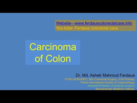 Colon cancer
